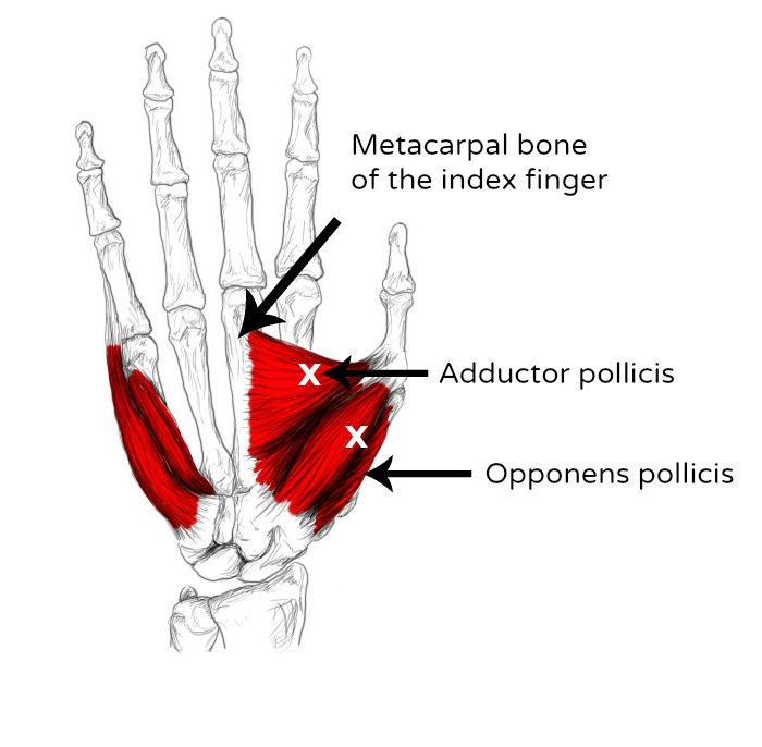 Músculo oponente del pulgar Dolor y puntos gatillo