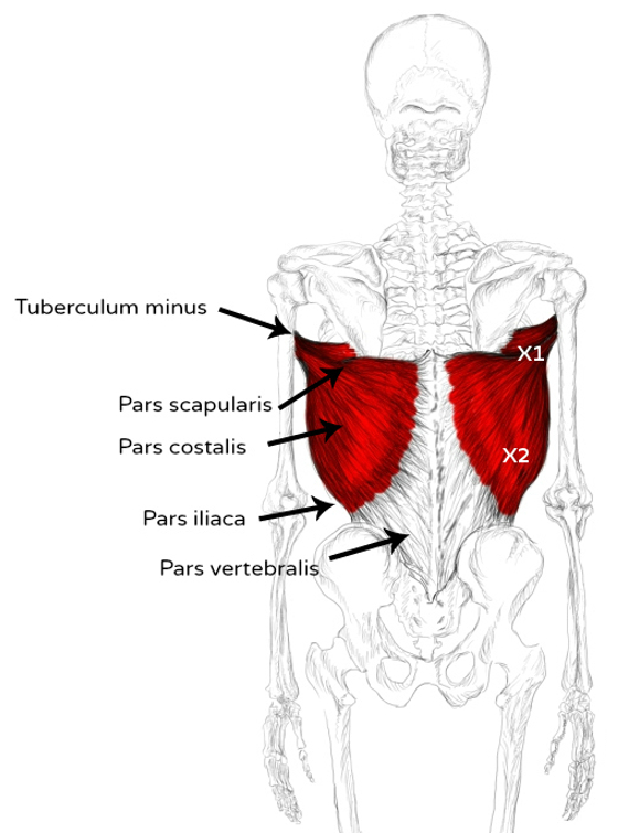 Músculo dorsal ancho: Dolores y puntos gatillo